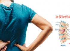 消滅坐骨神經痛不必挨刀！　勤練「3式舒緩妙招」讓筋骨軟回來